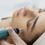 Dermapen Teneriffa