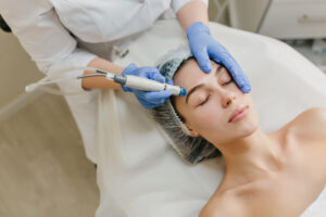 Dermapen en Tenerife con Spawellplus