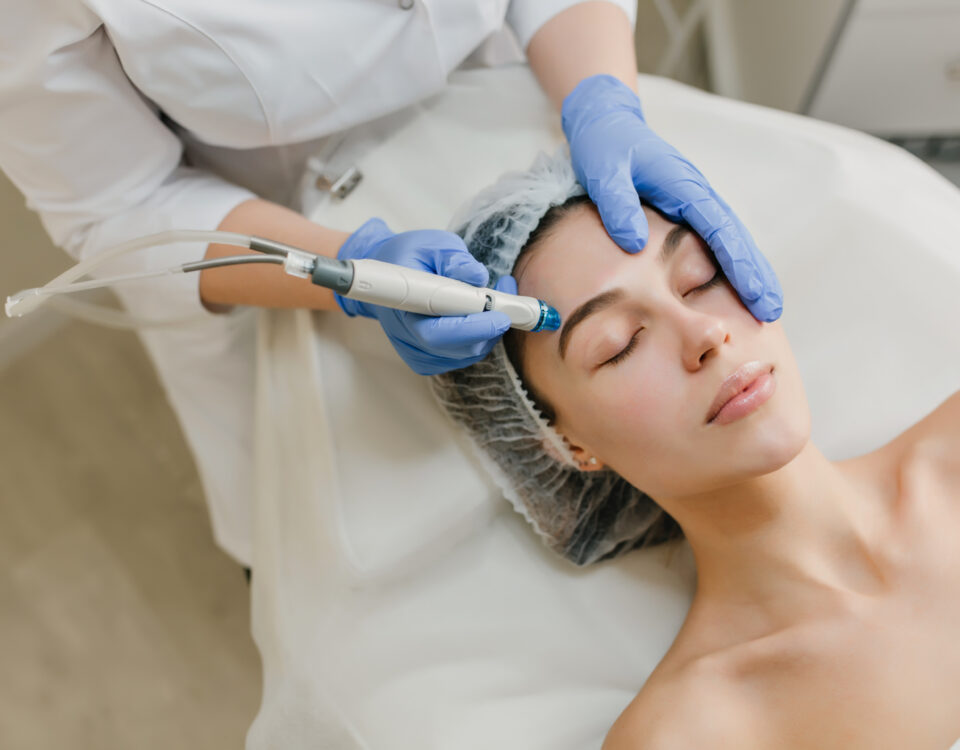 Dermapen en Tenerife con Spawellplus